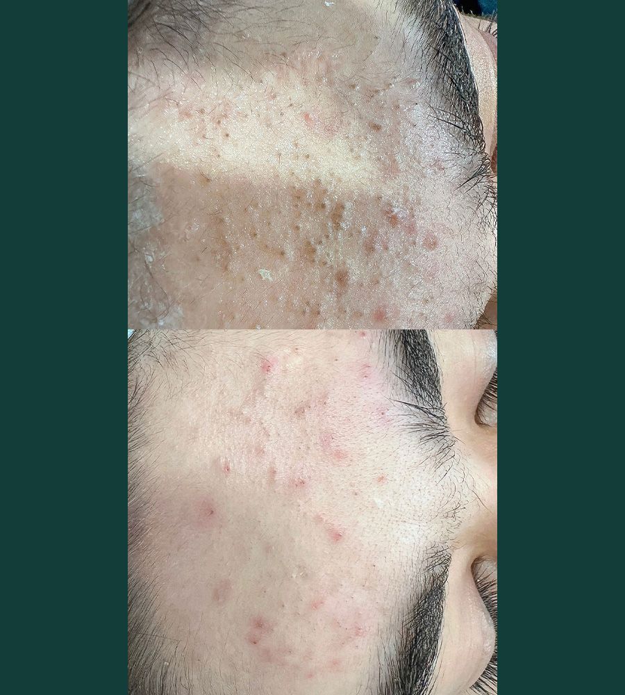 Advanced Skin IS